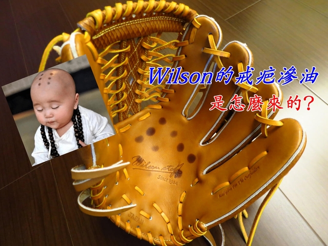 【圓圓小舖】魏二嬸(Wilson)棒球手套的戒疤滲油是怎麼來的？